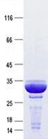 Human PTH / Parathyroid Hormone Protein (Recombinant TRX-His, N-terminus)