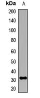 Polyclonal Rabbit anti-Human KCNIP2 / KCHIP2 Antibody (WB)