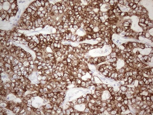 Monoclonal Mouse anti-Human KRT19 / CK19 / Cytokeratin 19 Antibody (clone UMAB188, aa240-390, IHC, IF, WB)