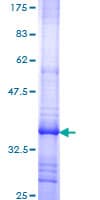 Human SLCO1B1 / OATP2 Protein (Recombinant GST, N-terminus)