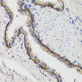 ATP1A1 Antibody