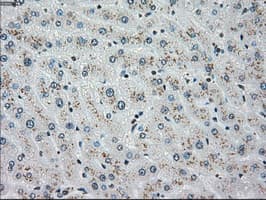 CHEK2 / CHK2 Antibody (clone OTI5C4)