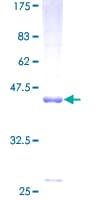 Human Dynactin 3 / DCTN3 Protein (Recombinant GST)