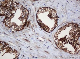 PAI-RBP1 / SERBP1 Antibody (clone OTI5G2)