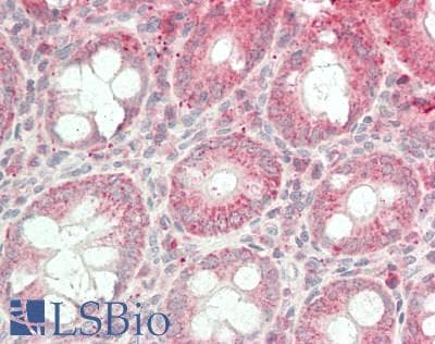 CTDNEP1 / DULLARD Antibody (HRP)