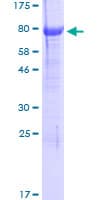 Human NGFR / CD271 / TNR16 Protein (Recombinant GST)