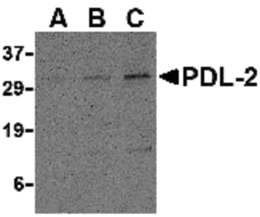 PD-L2 / PDCD1LG2 / CD273 Antibody