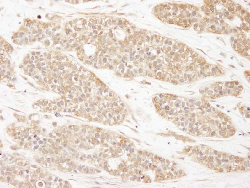 CC2D1A Antibody (aa1-50)