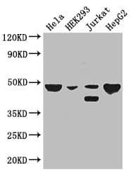 PLIN3 / M6PRBP1 / TIP47 Antibody