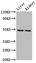 Polyclonal Rabbit anti-Human DLST / E2 Antibody (IHC, IF, WB)