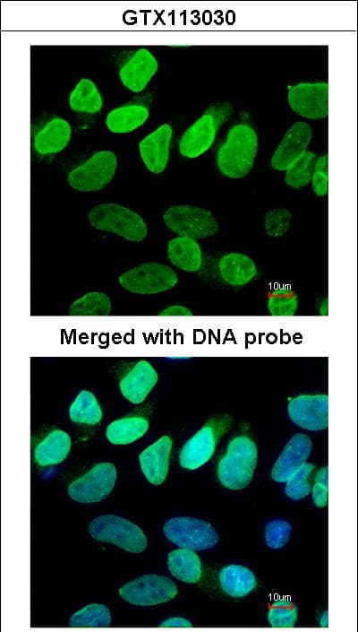 IHC-plus™ VCP Antibody (aa1-206)