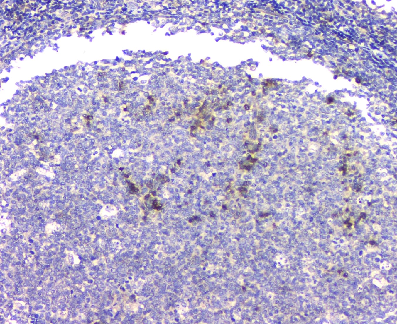 APP / Beta Amyloid Precursor Antibody (aa672-713)