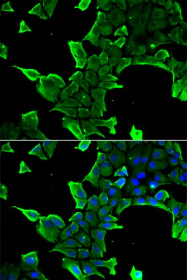 Polyclonal Rabbit anti-Human NCS1 / Neuronal Calcium Sensor Antibody (IHC, IF, WB)