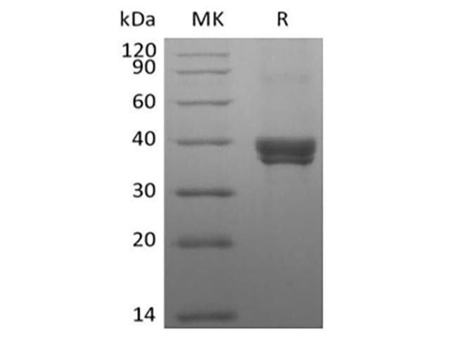 Human CLEC4M / L-SIGN / CD299 Protein (Recombinant 8His-DDK (Flag), N-terminus)