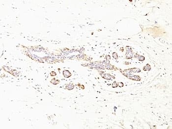 SMMHC / MYH11 Antibody (clone MYH11/923 + SMMS-1, Ready-to-Use)