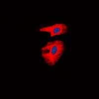 COL1A2 / Collagen I Alpha 2 Antibody (Internal)