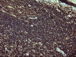 IHC-plus™ CD45 / LCA Antibody (clone 4C11)