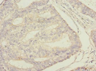 Polyclonal Rabbit anti-Human STAM2 Antibody (IHC, WB)