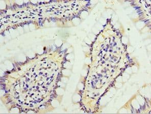 CD119 / IFNGR1 Antibody (aa270-489)