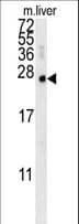 Polyclonal Rabbit anti-Human GLOD2 / MCEE Antibody (aa128-156, IHC, WB)