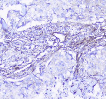 INPPL1 / SHIP2 Antibody