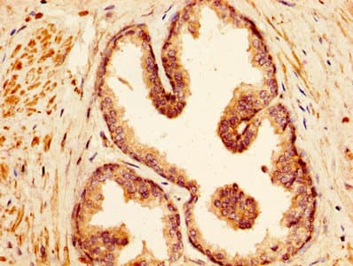 Vasohibin 1 / VASH1 Antibody (aa1-204)
