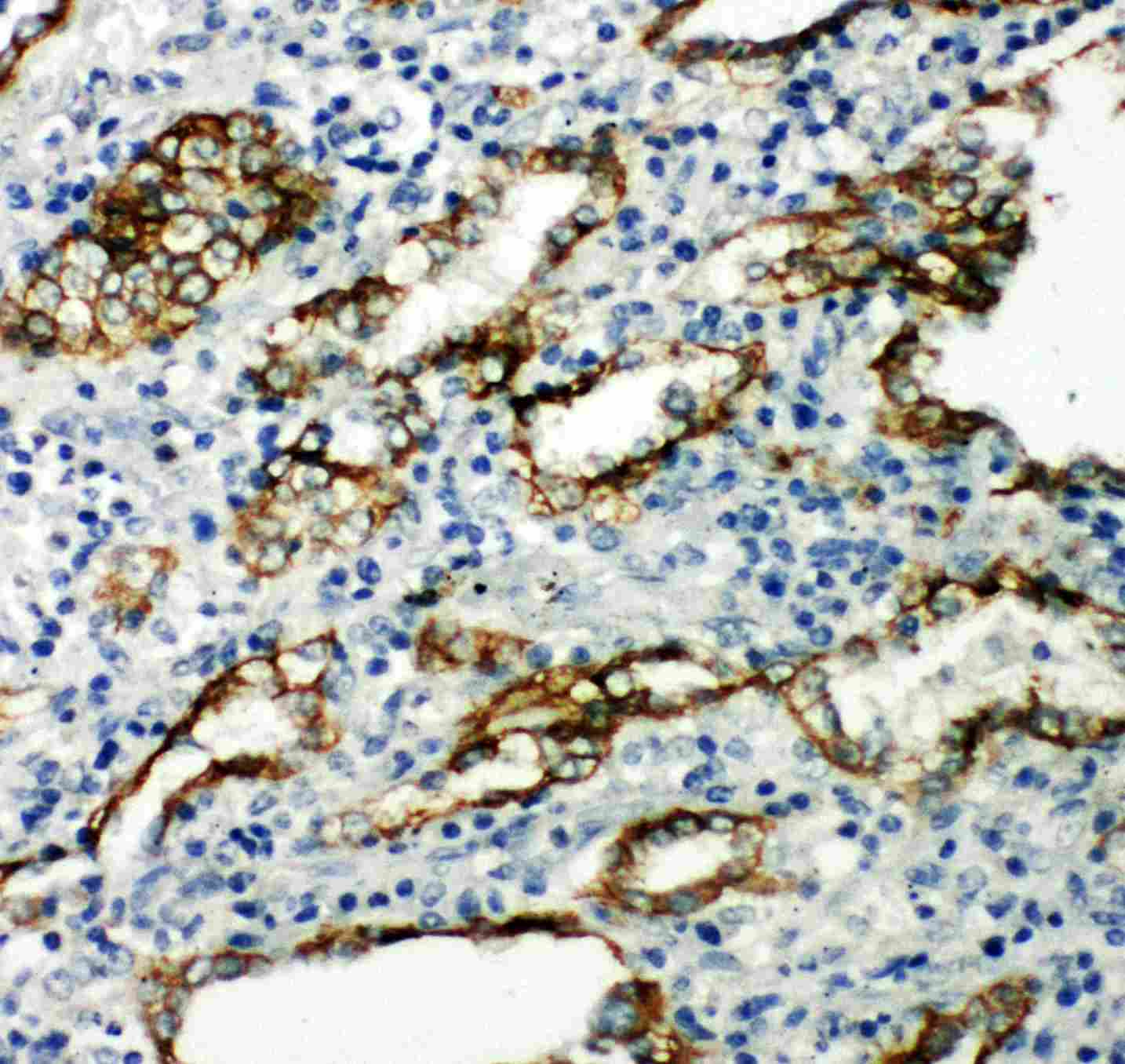 Polyclonal Rabbit anti-Human AQP4 / Aquaporin 4 Antibody (aa258-274, IHC, WB)
