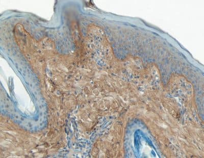 COL1A1 / Collagen I Alpha 1 Antibody