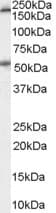 IHC-plus™ HTR3A / 5-HT3A Receptor Antibody (aa428-439)
