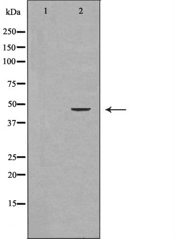 Polyclonal Rabbit anti-Human IDO1 / IDO Antibody (IHC, IF, WB)