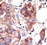 MUSK Antibody (aa829-859)