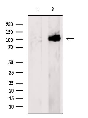 Polyclonal Rabbit anti-Human COG3 Antibody (WB)