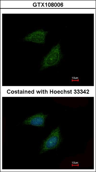 PI15 Antibody (aa195-258)