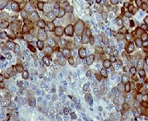 NGFR / CD271 / TNR16 Antibody (clone CDLA271)