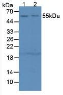 SERPING1 / C1 Inhibitor Antibody (aa211-331)