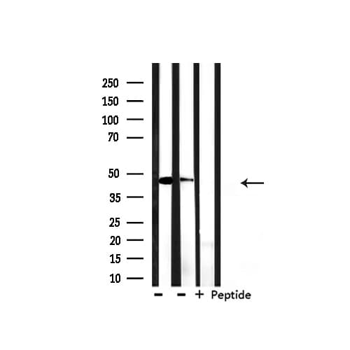 KRT18 / CK18 / Cytokeratin 18 Antibody