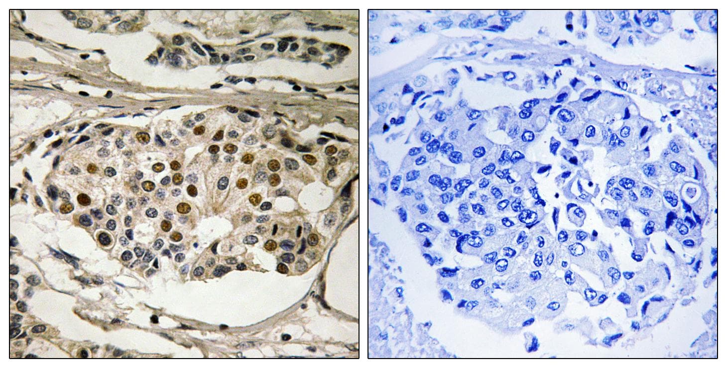 RELA / NFKB p65 Antibody (phospho-Ser281)