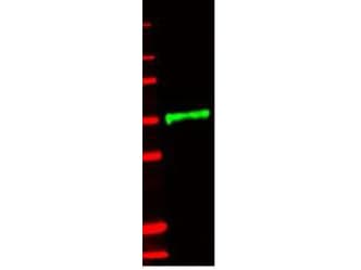 CD121b / IL1R2 Antibody