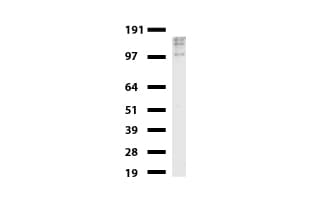 ERBB2 / HER2 Antibody (aa676-1255, clone UMAB35)