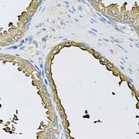 CRHBP Antibody