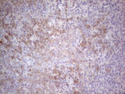 Monoclonal Mouse anti-Human PD-L2 / PDCD1LG2 / CD273 Antibody (clone OTI8G8, IHC, WB)