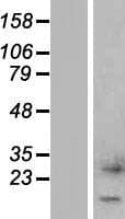 CTXN1 Protein (Over-Expression Lysate Myc-DDK (Flag))