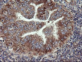 Monoclonal Mouse anti-Human VBP1 Antibody (clone OTI2C2, IHC, WB)