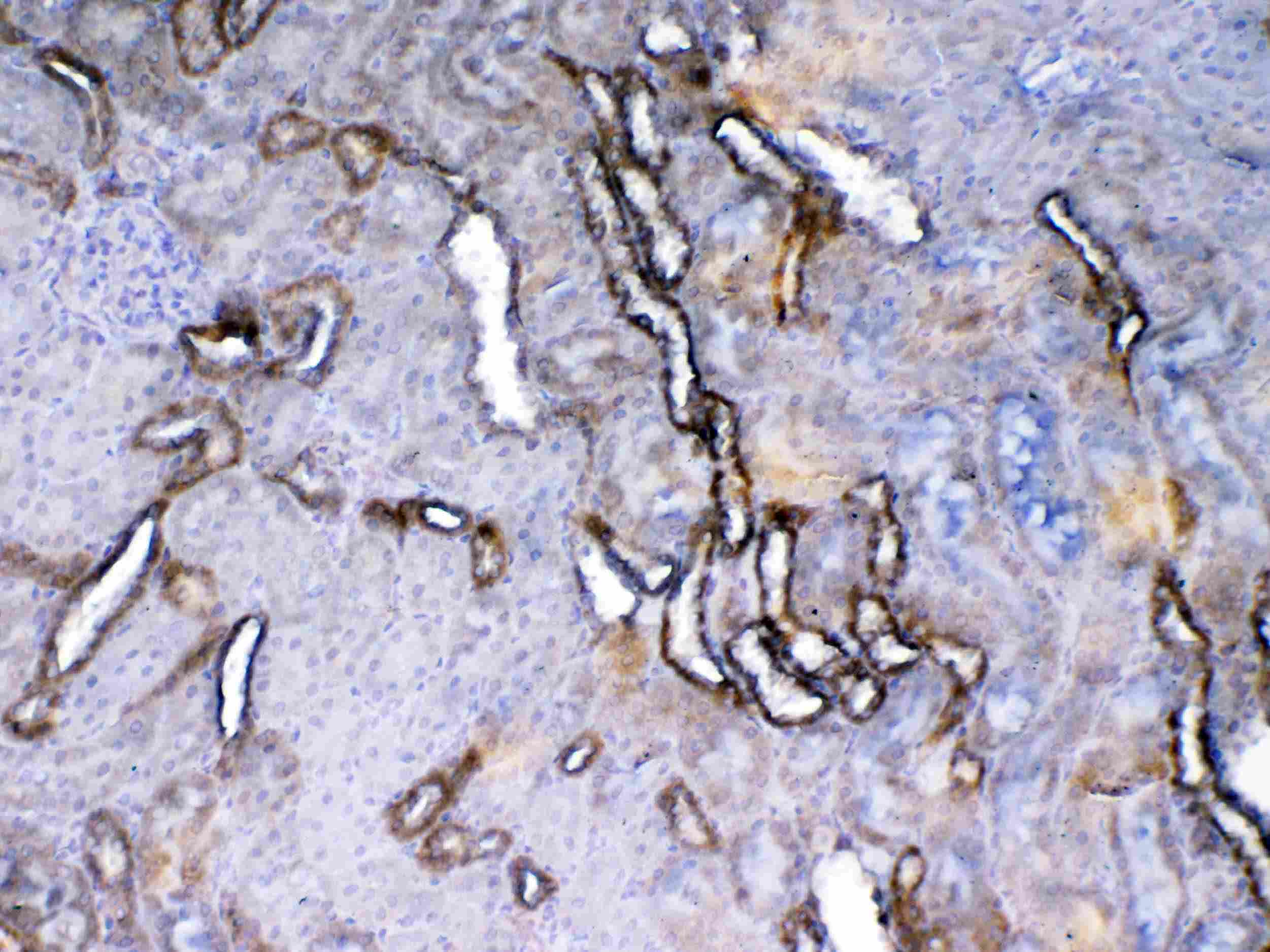KDR / VEGFR2 / FLK1 Antibody