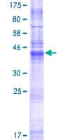 Human LHFPL5 Protein (Recombinant GST)