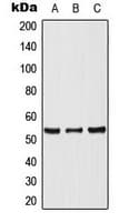 TP53 / p53 Antibody (C-Terminus)