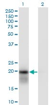 UBCH / UBE2H Antibody (clone 3C4-1A2)