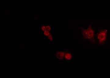 Polyclonal Rabbit anti-Human SF1 Antibody (IF, WB)