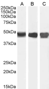 IHC-plus™ ASS1 / ASS Antibody (aa196-212)