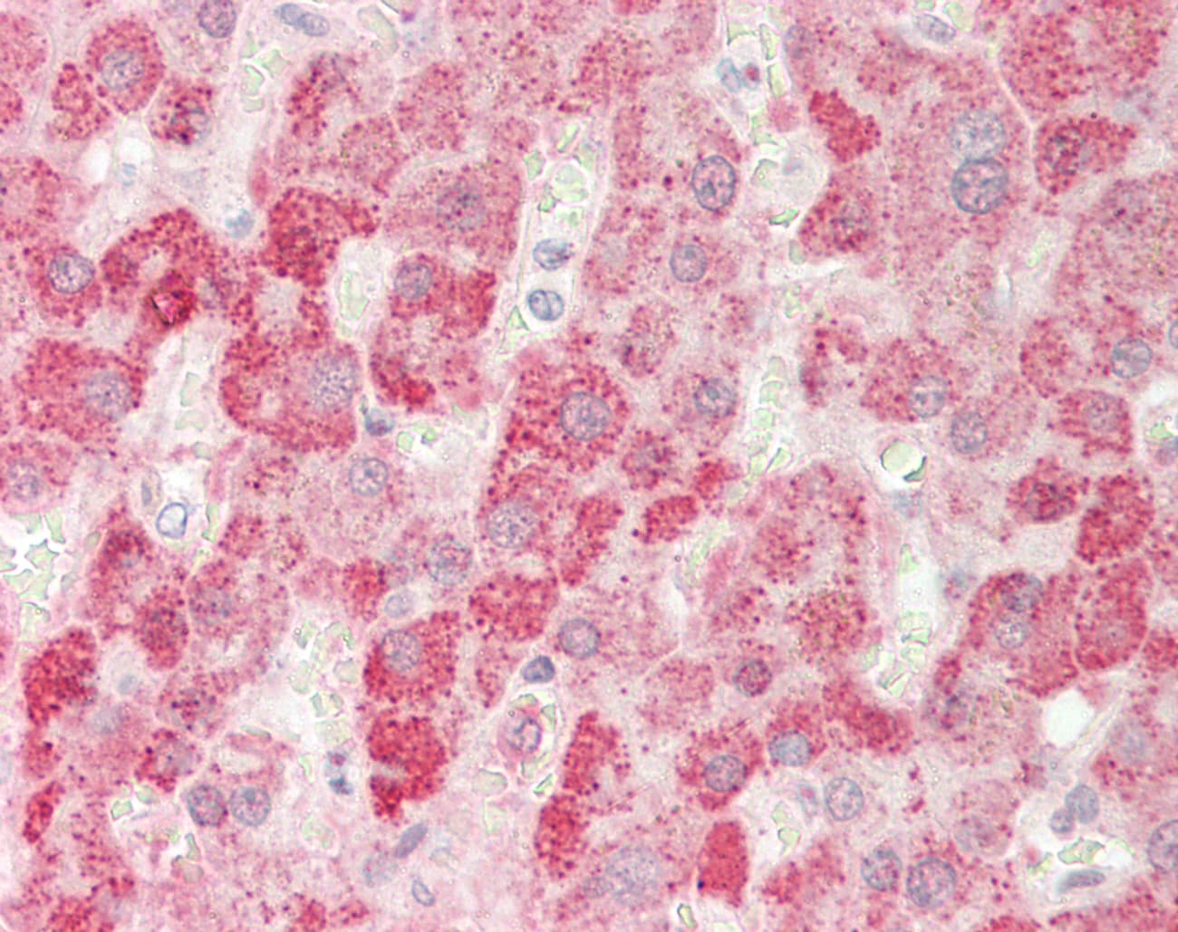 Polyclonal Rabbit anti-Human ALDH7A1 Antibody (aa35-84, IHC, WB)